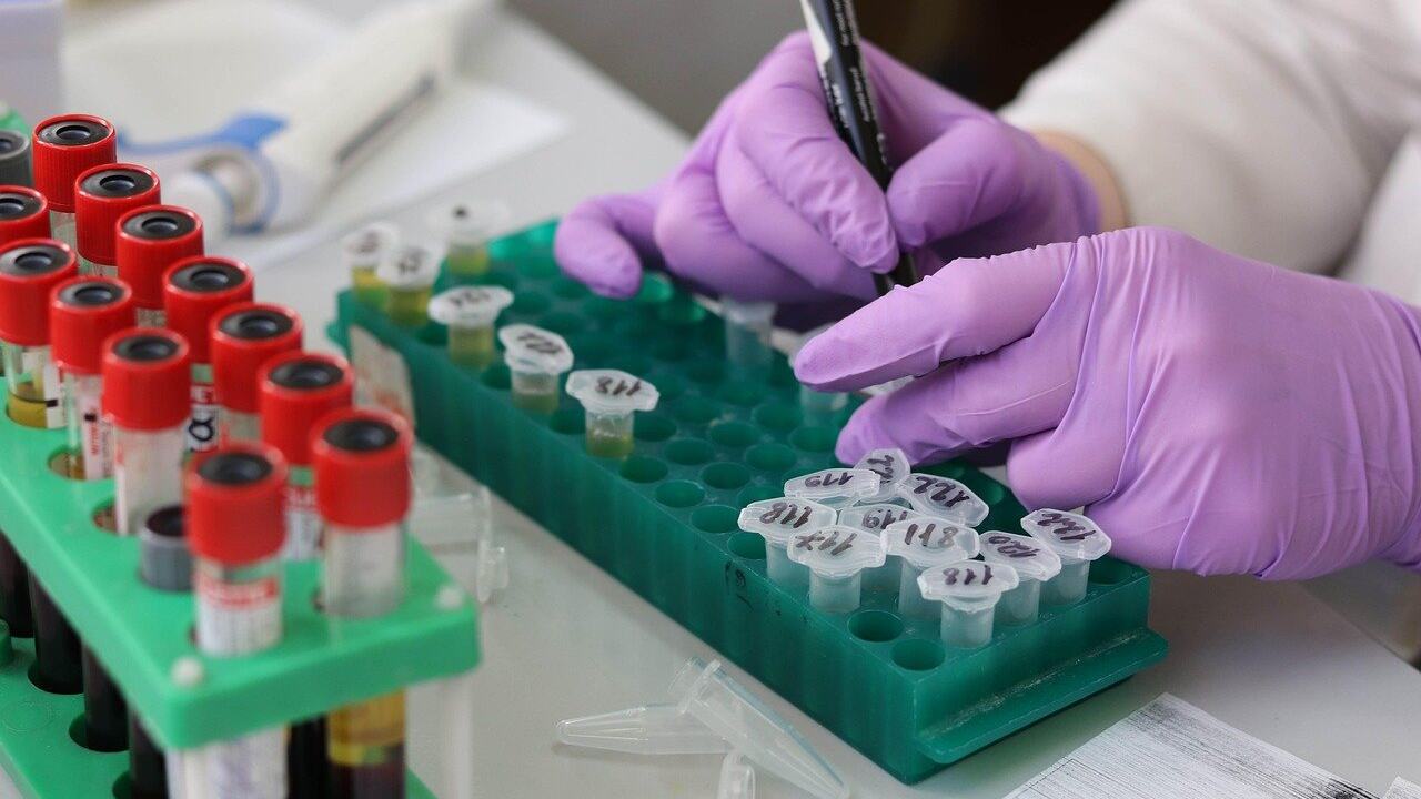 how often should you get cholesterol checked